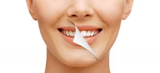 Cosmetic dentistry
Bright white smile
Perfect Teeth 
Botox
Dermal Fillers
Lip Fillers

